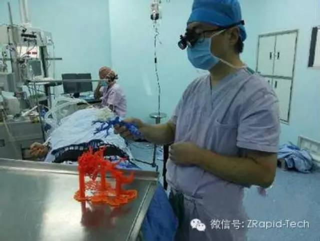 First time successfully use 3D print technology to assist remove liver tumor in Southwest China